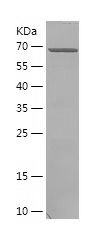 Recombinant Human CDC37