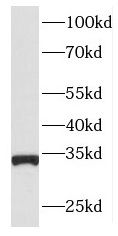 ING2 antibody