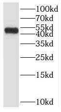 SMYD2 antibody