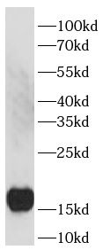 Pan Acetylation antibody