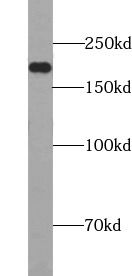 SMARCA4 antibody
