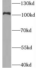 BRD2 antibody