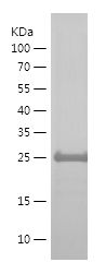 Recombinant Human MANBAL