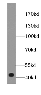 SIRPB1 antibody