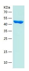 Recombinant Human RAB20