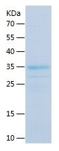 Recombinant Human CENPK