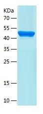 Recombinant Human CARNS1
