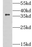 CLYBL antibody