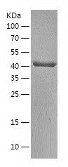 Recombinant Human BCKDHA