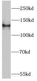 EML4 antibody