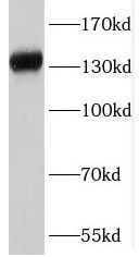 SKIC2 antibody