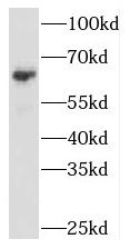 NARS1 antibody