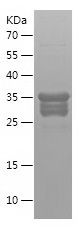Recombinant Human HMGB1