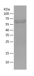 Recombinant Human IKBKG