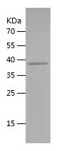 Recombinant Human CYP2C8