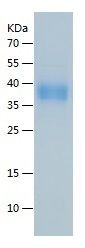 Recombinant Human EPCR