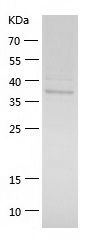 Recombinant Human ADH5