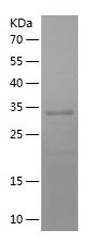 Recombinant Human WT1