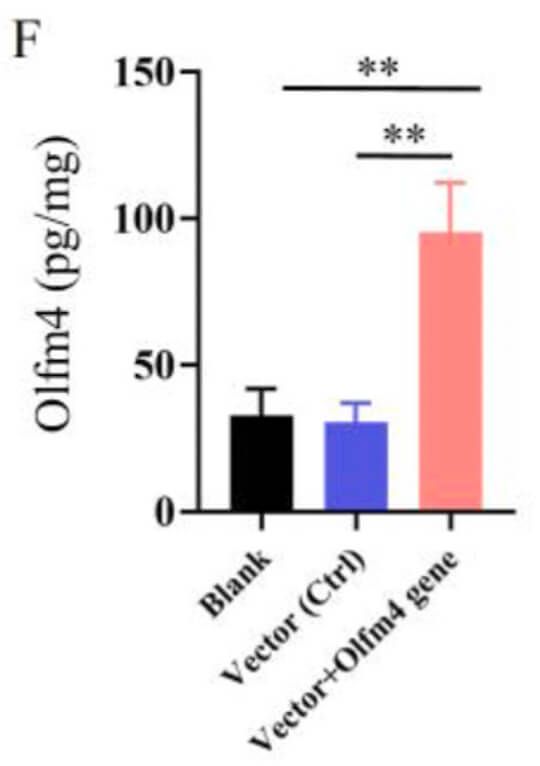 [Cited FineTest ELISA Kit] Current Research on Ischemia Reperfusion Injury