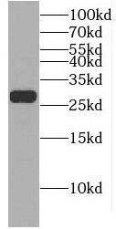 EIF4E2 antibody