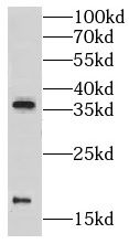 GR repeat antibody