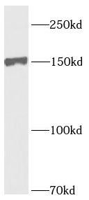 PDGFRA antibody