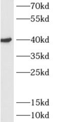 ADH6 antibody
