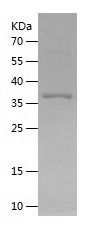 Recombinant Human CYP7B1