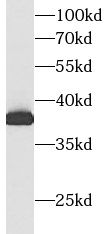 ALDOC antibody