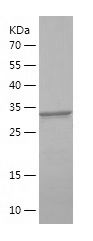 Recombinant Human IRS2