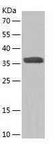 Recombinant Human SULT1C2