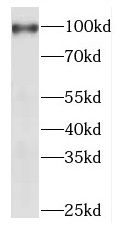 MEPE antibody