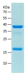Recombinant Human KHDC1L