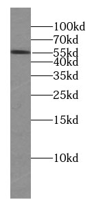 HDAC2-specific antibody