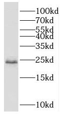 SCML1 antibody