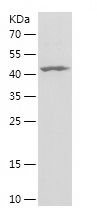 Recombinant Human AHCY