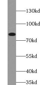 MLH1 antibody