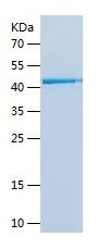 Recombinant Human EIF2S2