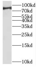 POGK antibody