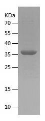 Recombinant Human C4A