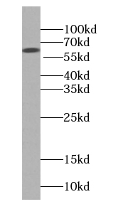 KNG1 antibody