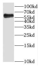 KLHL31 antibody