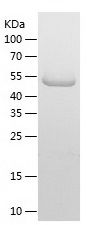 Recombinant Human DDX21