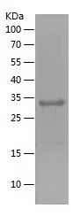 Recombinant Human ZKSCAN3