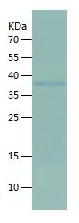 Recombinant Human FAM83A