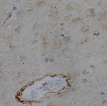 EPHA6 antibody