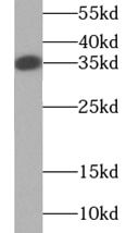 TNFSF11 antibody