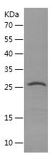 Recombinant Human TFAM