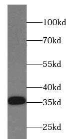 CD74 antibody