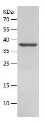 Recombinant Human TCPTP